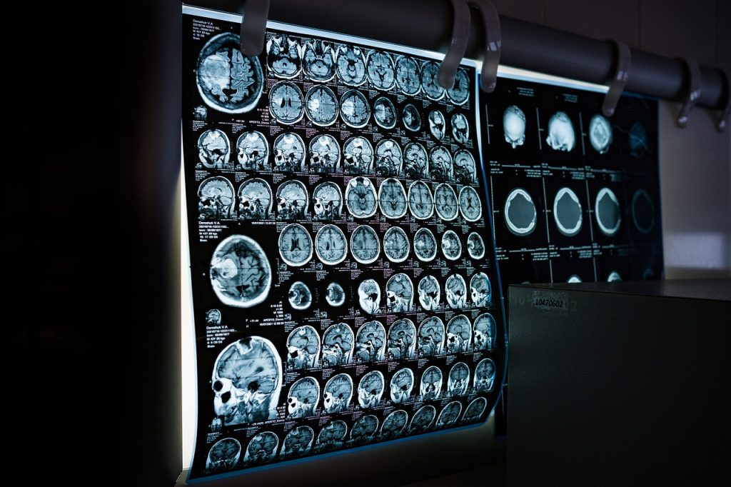 X ray 6841384