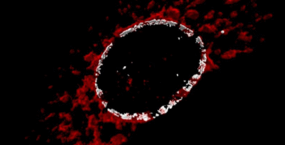 Reticulo endo plasma