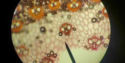 Pexels lidija ostojic 520091004